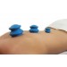 Acucups Natural Rubber Cupping Therapy Set 01